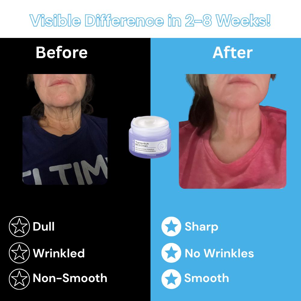 Moika SmoothGlow Neck Cream